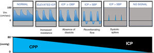 Classical and chronological patterns of cerebral circulatory arrest and its relation to cerebral perfusion pressure (CPP) and intracranial pressure (ICP). DBP: diastolic blood pressure; SBP: systolic blood pressure.