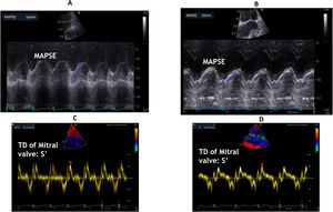 Left ventricular ejection fraction surrogates: mitral annulus plane systolic excursion (MAPSE) (A, B), and Tissue Doppler peak systolic wave at the mitral lateral annulus (S′) (C, D).