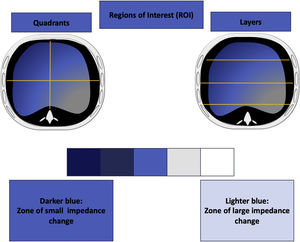 Representation of changes in impedance and aeration. Legend: the lighter blue color corresponds to an area that has shown a large impedance change. Correlative, therefore, to a well-ventilated lung area. The darker blue shade color represents areas with less impedance change. Correlative to a lung zone with less aeration. Regions of interest are observed in quadrants or in layers. Each of the regions of interest expresses a percentage of the total tidal impedance change.