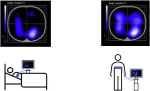 Effects of physical therapy and body position on lung impedance. Legend: position 1: bed rest position. First average image of EELI. Position 2: stand up and walk beside bed. Last average image of EELI.