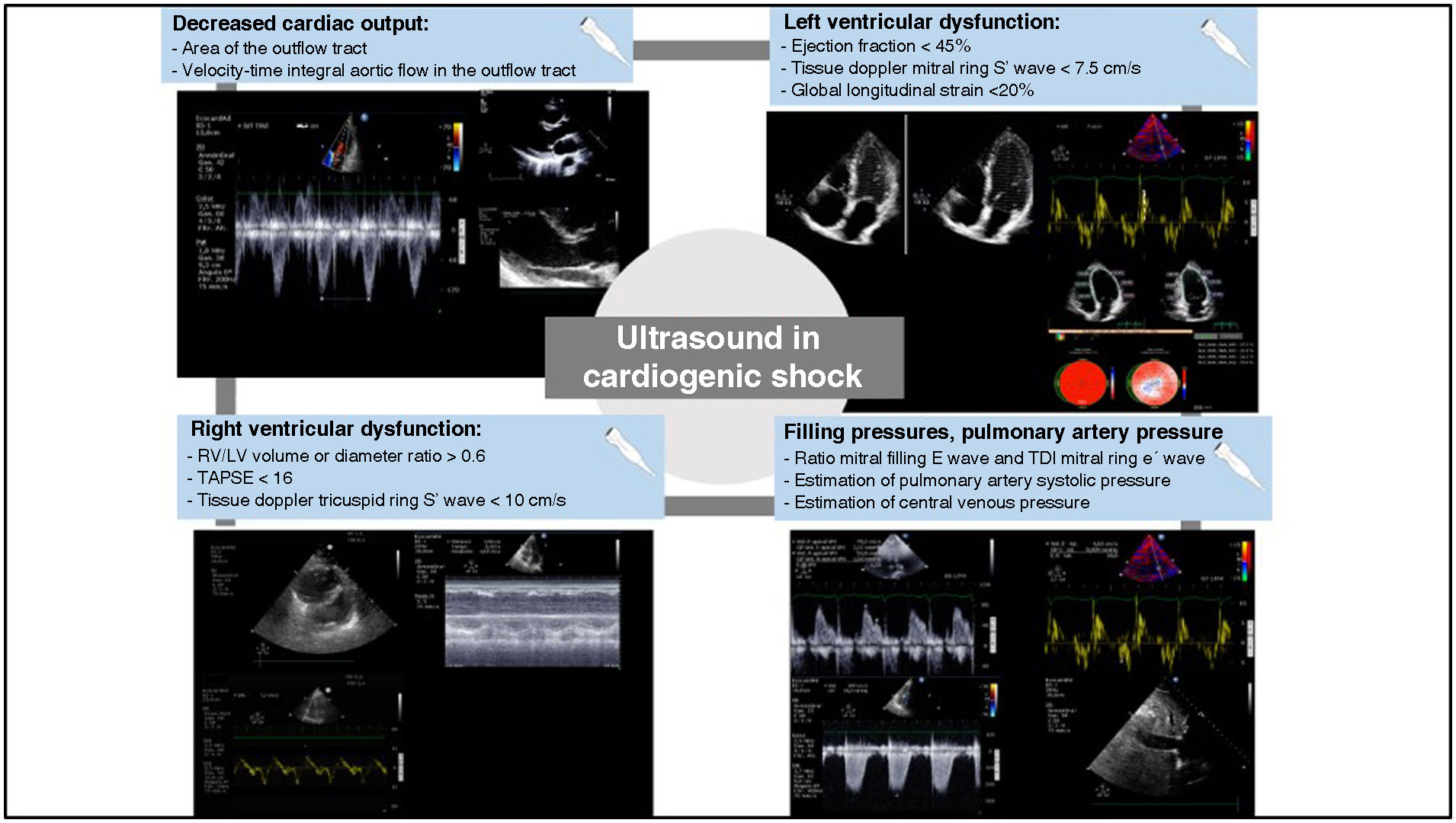 Hemodynamic monitoring and echocardiographic evaluation in cardiogenic ...