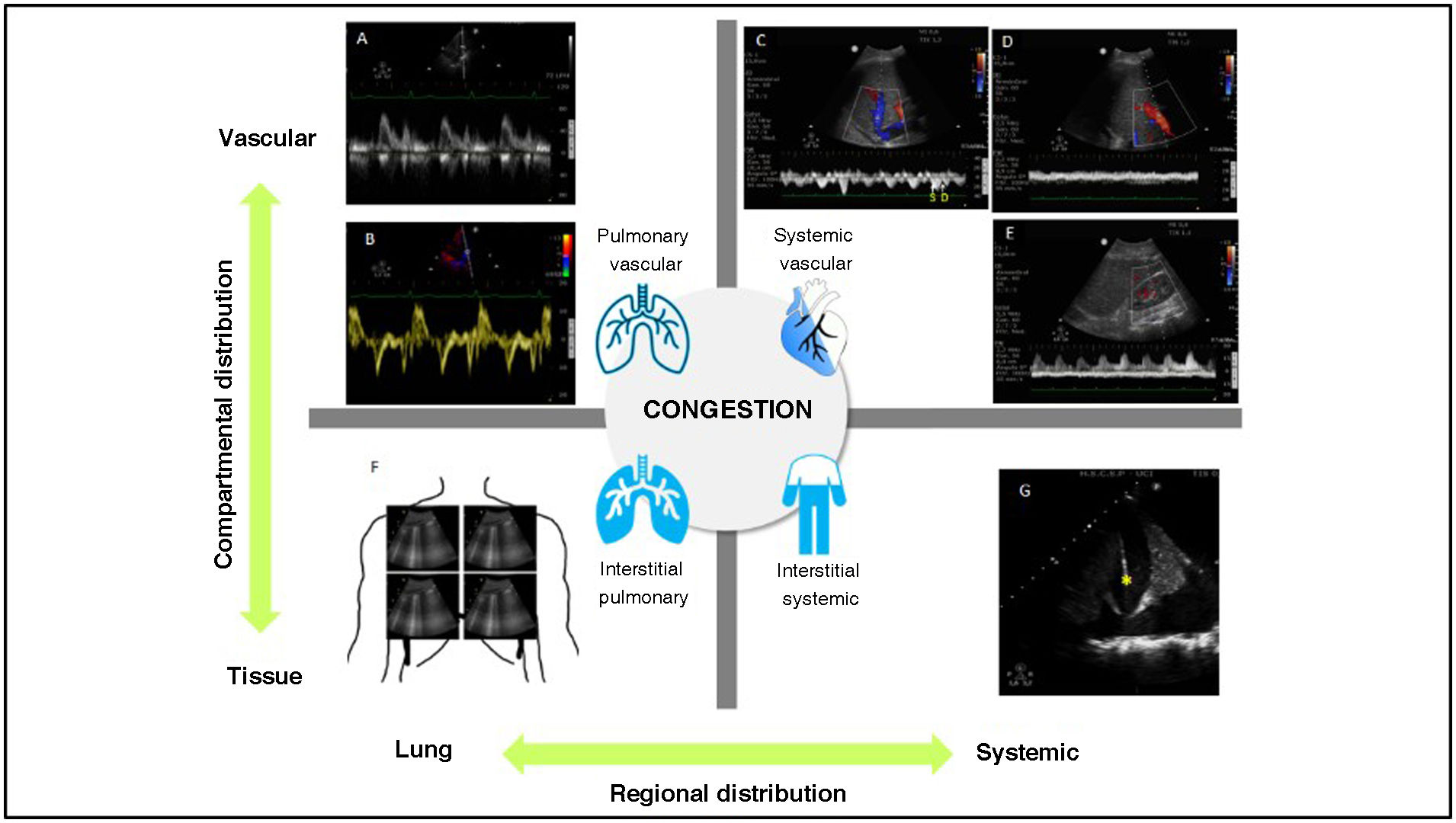 Hemodynamic monitoring and echocardiographic evaluation in cardiogenic ...