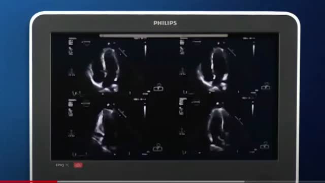 https://ars.els-cdn.com/content/image/1-s2.0-S2173572724002364-mmc3.mp4