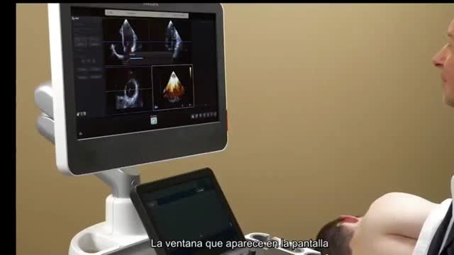 https://ars.els-cdn.com/content/image/1-s2.0-S2173572724002364-mmc6.mp4
