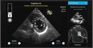 Two-plane views of a study made with the help and guidance of Caption AI© and Caption Guidance©. Different aid items are available that guide the transducer until an optimum plane is recognized and obtained (including even classification of the degree of optimization achieved). The best loop is automatically recorded, and the measures that can be obtained from it are displayed.