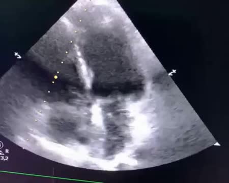https://ars.els-cdn.com/content/image/1-s2.0-S2173572724001711-mmc2.mp4