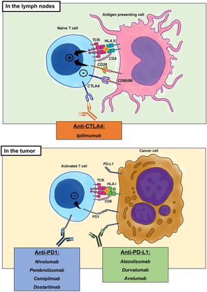 Sites of action of the different ICI used in clinical practice. + denotes cellular activation and – refers to cellular inhibition. TCR: T cell receptor. HLA: human leukocyte antigen. CD: cluster of differentiation. CTLA 4: cytotoxic T lymphocyte antigen 4. PD-1: programmed death receptor 1. PD-L1: programmed death receptor antigen. Illustration made by the author, based on the text and inspired by the figures used int the article by MareI et al.1