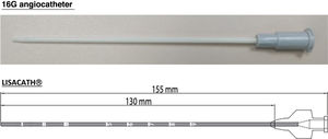 Catheters used in the LISA technique: 16G angiocatheter (image obtained by the author) and LisaCath®.19,20