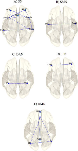 Representation of the decreased connectivity between regions of comatose patients compared to healthy controls. The regions are part of the Salience Network (A), SensoriMotor Network (B), Dorsal Attention Network (C), FrontoParietal Network (D), and Default-mode Network (E).