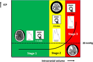 Stages in the development of the intracranial compartmental syndrome.