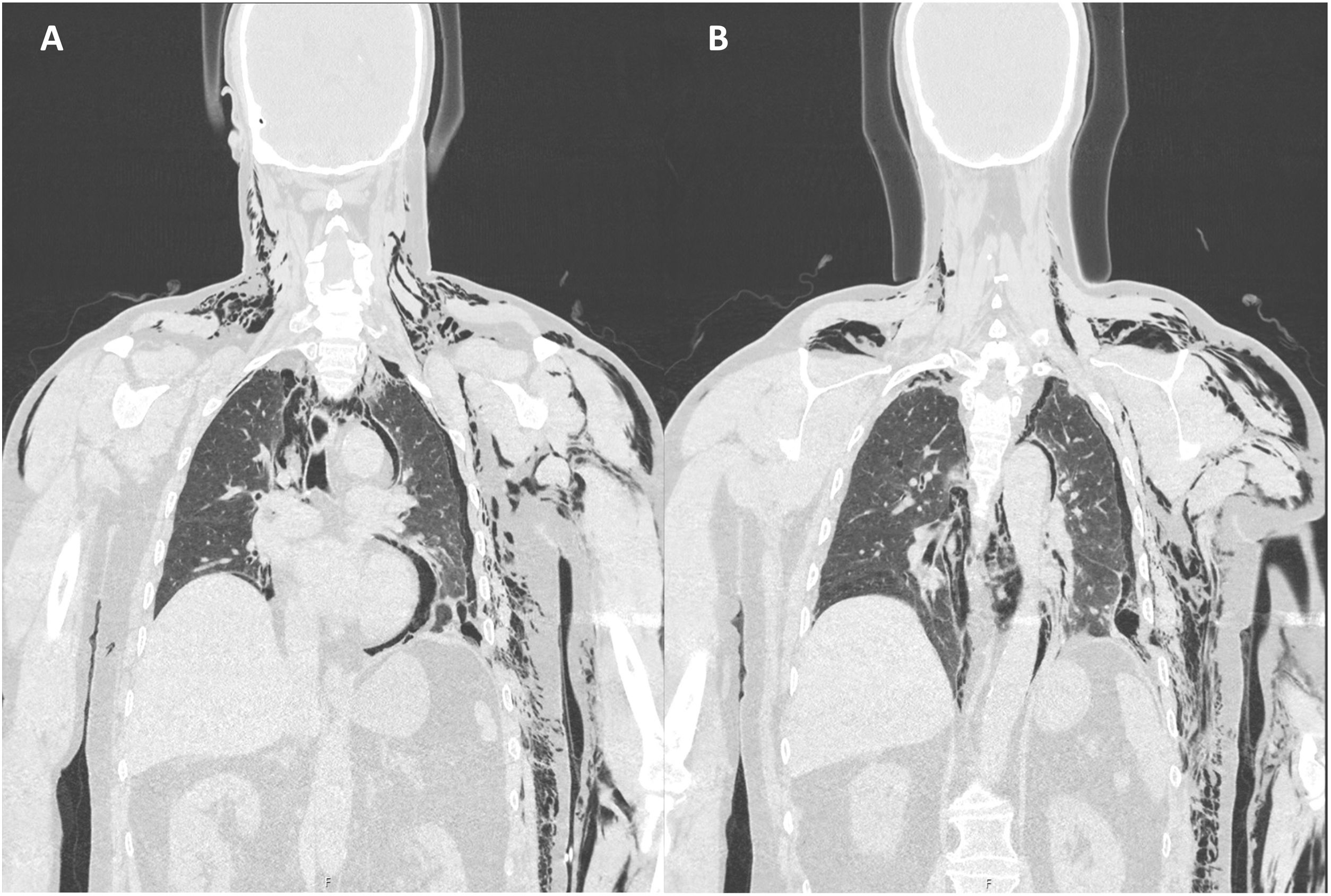 fig0005