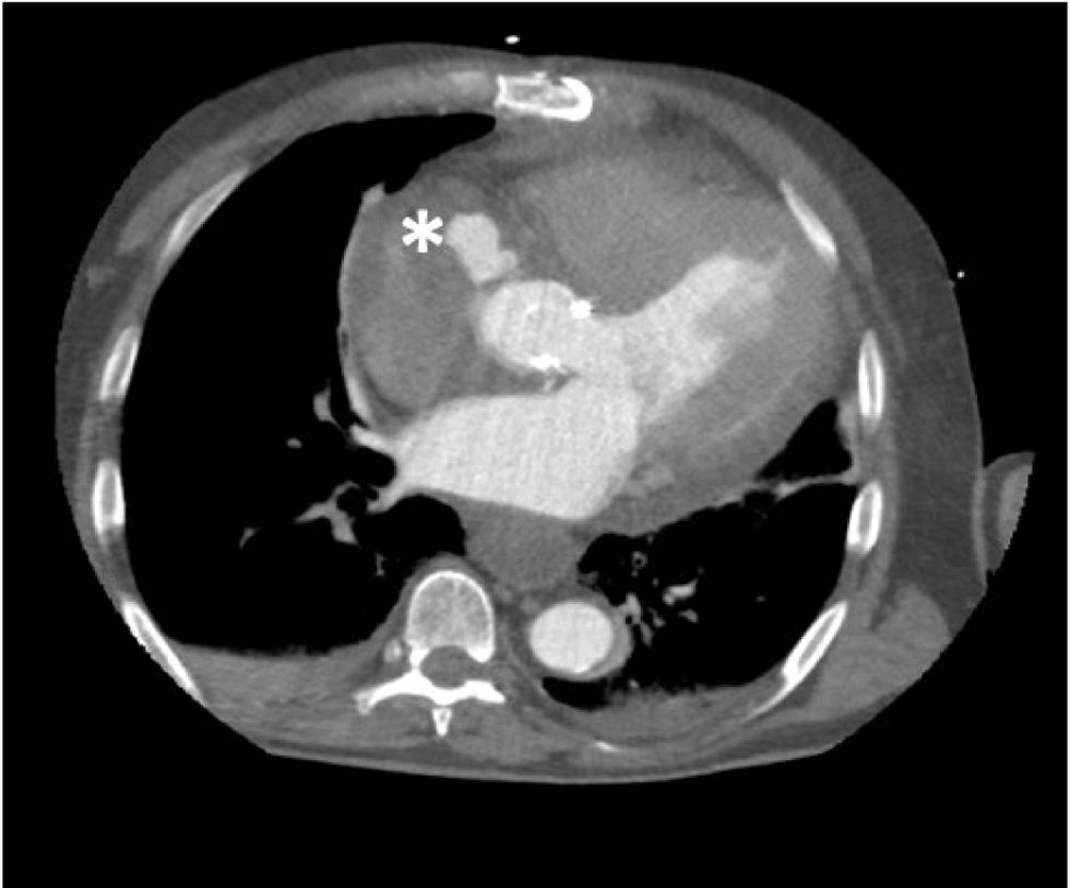 fig0010
