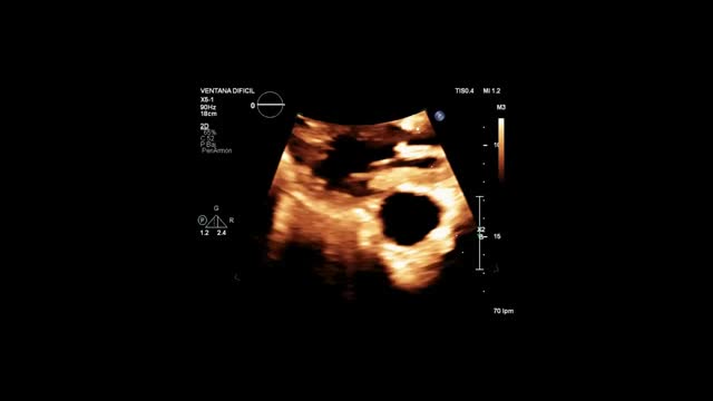 https://ars.els-cdn.com/content/image/1-s2.0-S2173572725001018-mmc6.mp4
