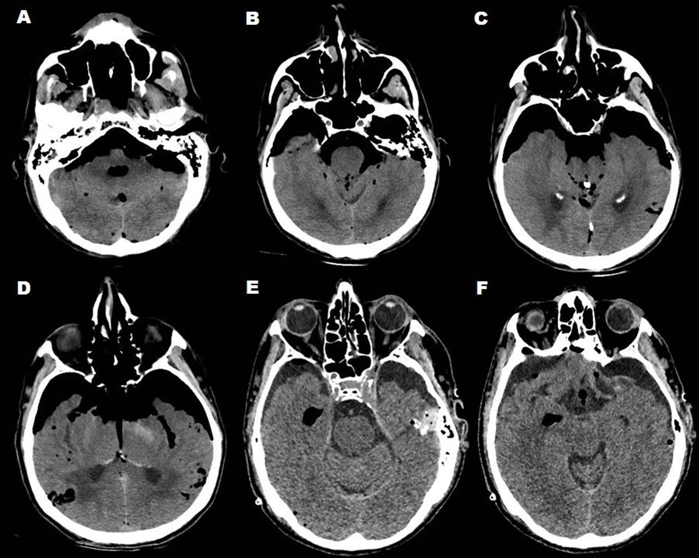 fig0005