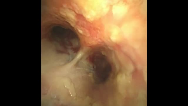 https://ars.els-cdn.com/content/image/1-s2.0-S2173572725002371-mmc1.mp4