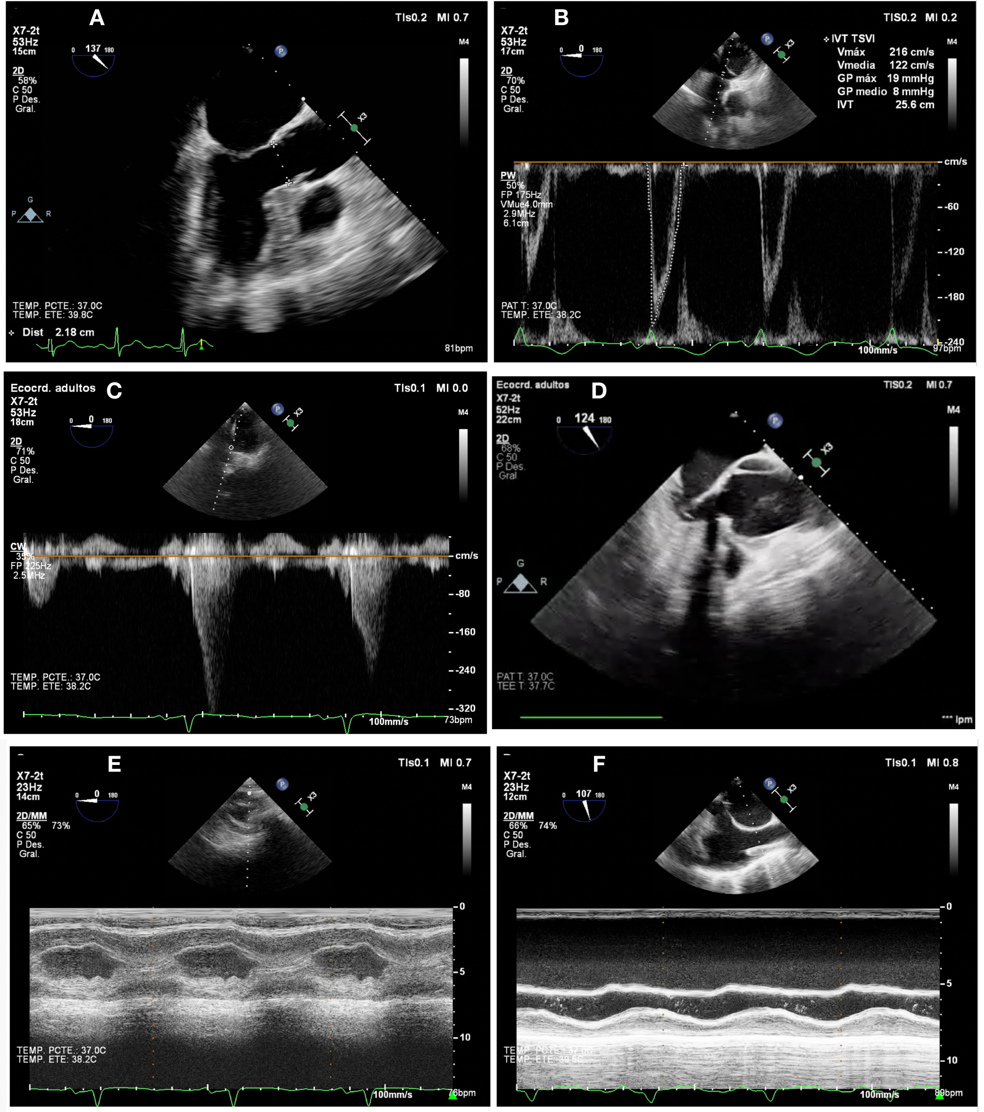 fig0015