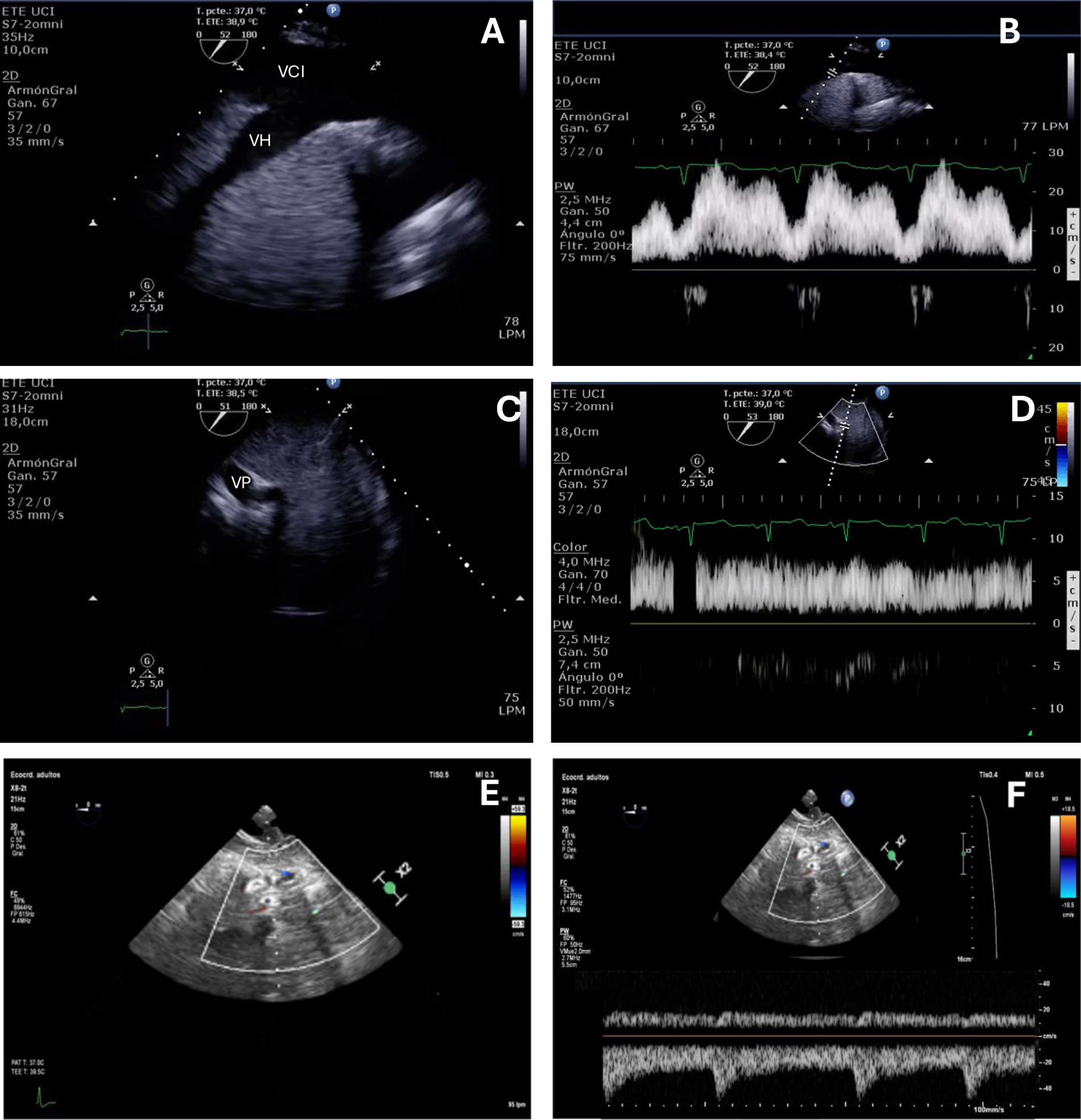 fig0020