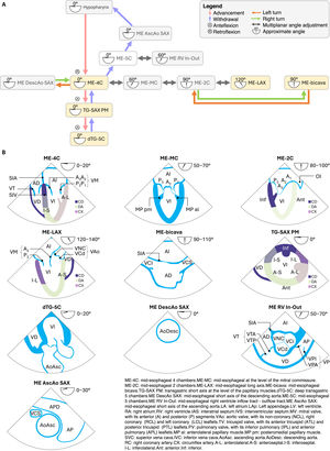 Basic and complementary sequence of the TEE study in critically ill patients: A) Schematic representation of the basic (yellow) and complementary (gray) sequences for TEE exploration in the critically ill patient. B) Nomenclature and basic anatomy of the views obtained in the basic and complementary exploration sequences.
