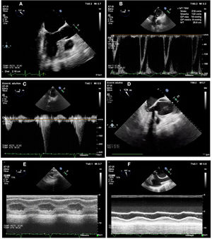 Study images of the patient in shock and volume response parameters.