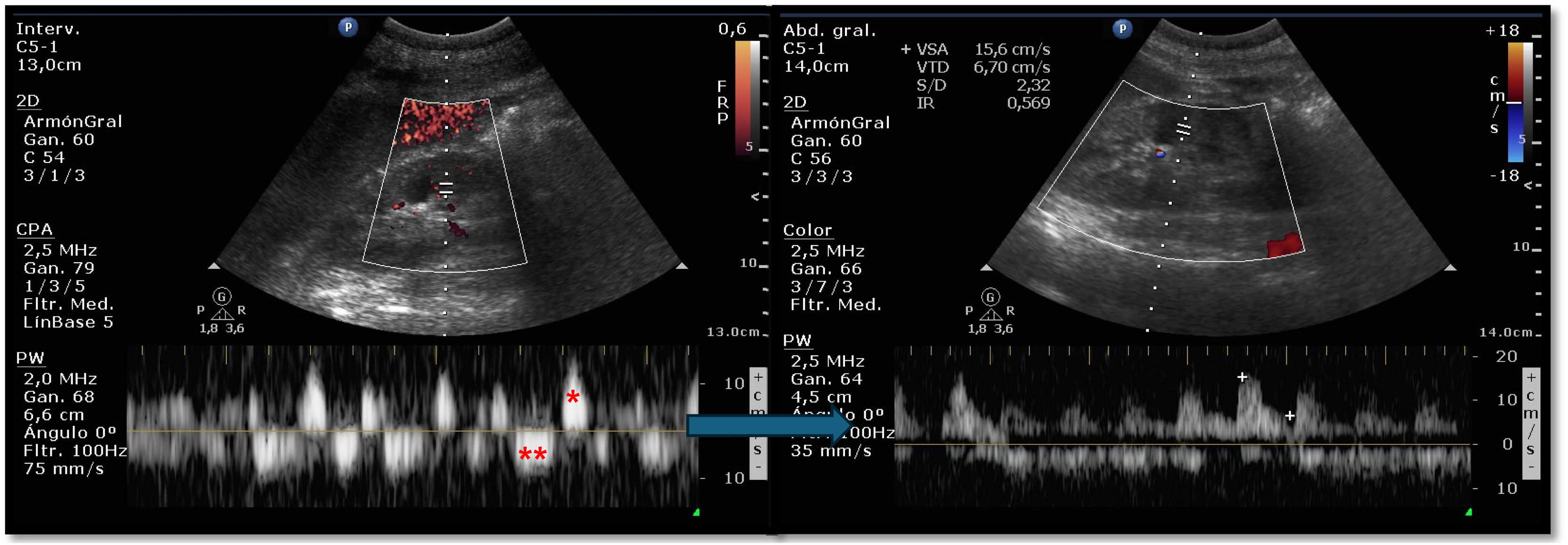 fig0005