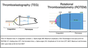 Diagram of thromboelastography (TEG) and rotational thromboelastometry (ROTEM). Diagram of thromboelastography (TEG) and rotational thromboelastometry (ROTEM).