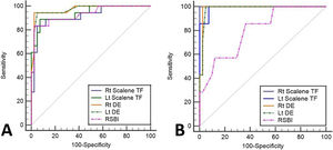 Receiver operating characteristics curve. A-for the ability to predict failed SBT, B-for the ability to predict reintubation. DE: diaphragmatic excursion, RSBI: rapid shallow breathing index, SBT: spontaneous breathing trial, TF: thickening fraction.