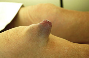 Side view of the right knee of the patient.