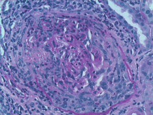 PAS positive slide ×40 with a circumferential crescent.