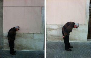Increase in the spinal curvature, which becomes more pronounced with walking.