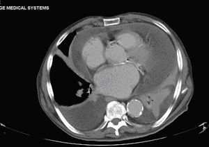 CT of the chest and abdomen.