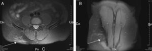 Axial and coronal planes of the patient