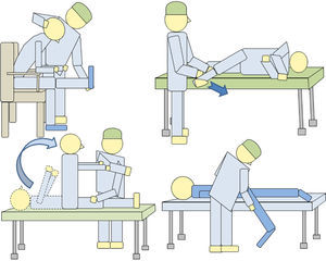 Illustration showing different ways to perform nerve root stretching maneuvers. Its purpose is to detect exploratory discrepancies.