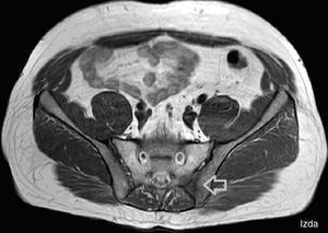 Abdominopelvic computed tomography.