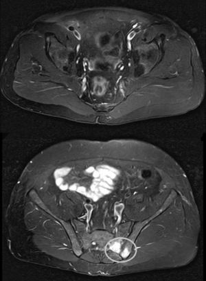 Follow-up magnetic resonance image.