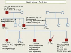 Family tree or genogram. Paternal family line affected. Autosomal dominant inheritance.
