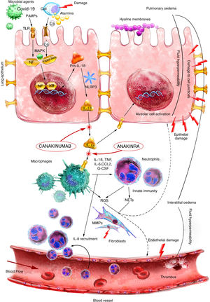 Proposal for the use of anakinra in acute respiratory distress ...