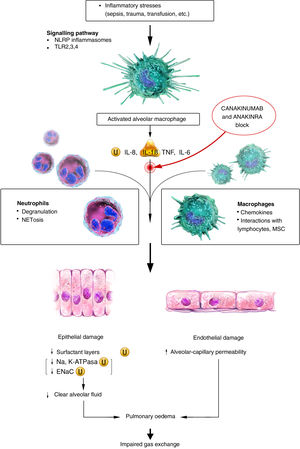 Pathophysiology of ARDS. The initial inflammatory stimulus activates alveolar macrophages through TLR and NLRP signalling. Activated alveolar macrophages release proinflammatory cytokines and recruit circulating macrophages and neutrophils to injury sites. This influx of persistently activated neutrophils and macrophages causes extensive damage to epithelial and endothelial lung tissue, resulting in an impaired alveolar-capillary barrier. ENaC: Epithelial sodium channel; Na: Sodium; NETs: Neutrophil Extracellular Traps; TLR: Toll-like receptor; U: Ubiquitination. Source: version adapted from the original by Seung Hye Han et al. Scientific illustrator: Miguel Soto.