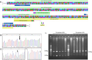 Genotyping of M694V polymorphism. (A) The schematic illustration of M694V polymorphism site on MEFV gene and the primers designed for genotyping. The chromatograms representing normal homozygote (B), heterozygote (C), and M694V homozygote (D) states which were perfomed for the validation of genotyping. (E) Genotyping of M694V polymorphism by ARMS-PCR. Lane M, molecular-weight size marker; Lane 1, 2, and 3 indicate AG genotype and lane 4 and 5 indicate AA genotype.
