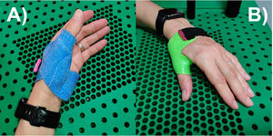 A) Nocturnal orthosis; B) Daytime orthosis.