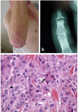 Fig. 1