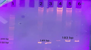 Examples of B*51:01 and B*27 locus-specific typing results. DNA ladder (Orange Ruler 50bp DNA Ladder, CinnaGen, Iran); (1) positive patient and (2) positive control (3) for B*27 allele; positive patient, (4) positive control (5, 6) for B*51:01 allele.
