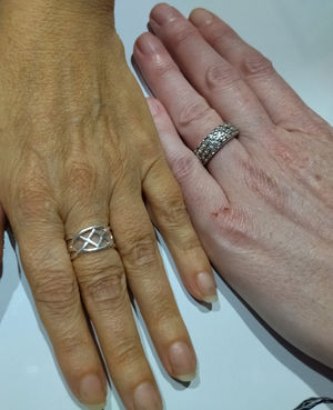 Yellowish skin pigmentation.