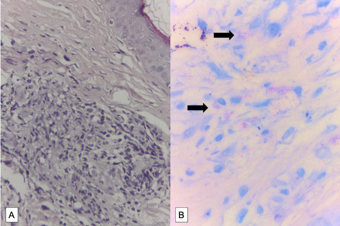 fig0020