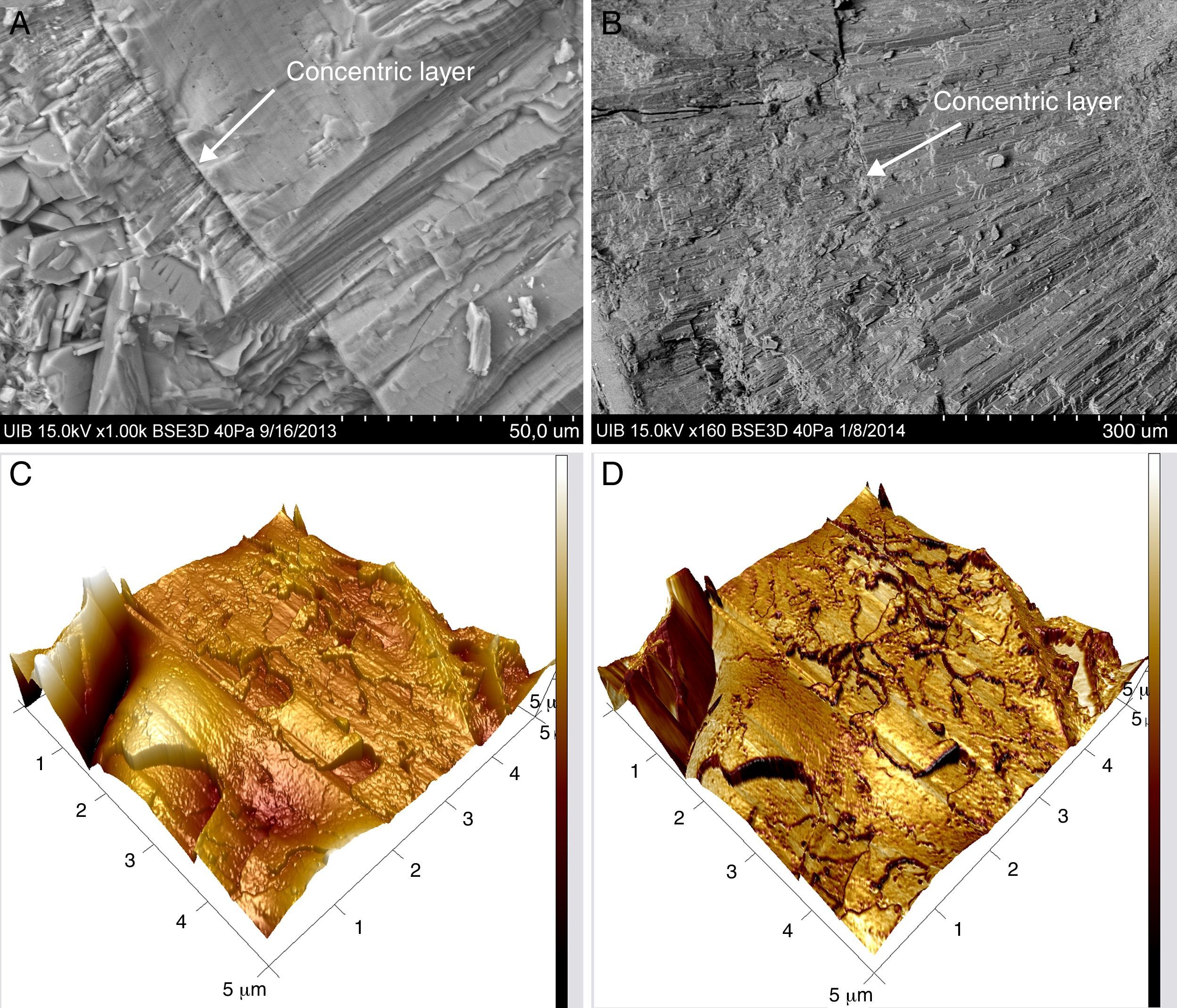 Ultrafine structure of calcium oxalate monohydrate renal calculi ...