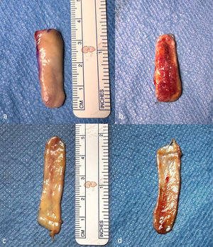 (a) Mucosal layer of the harvested BMG before removal of muscle tissue and fatty tissue. (b) Muscle layer of the harvested BMG before removal of muscle tissue and fatty tissue. (c) Mucosal layer of the harvested BMG after removal of muscle tissue and fatty tissue. (d) Muscle layer of the harvested BMG after removal of muscle tissue and fatty tissue.