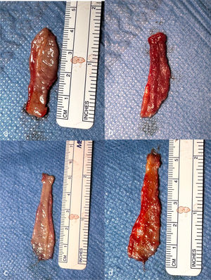 (a) Mucosal layer of the harvested SIMG before removal of muscle tissue and fatty tissue. (b) Muscle layer of the harvested SIMG before removal of muscle tissue and fatty tissue. (c) Mucosal layer of the harvested SIMG after removal of muscle tissue and fatty tissue. (d) Muscle layer of the harvested SIMG after removal of muscle tissue and fatty tissue.