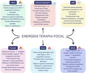 Main energy sources used in focal therapy for the treatment of localized prostate cancer. Each modality differs in its mechanism of action (thermal vs. non-thermal), approach, anesthetic requirements, and preferred tumor location. Abbreviations: IRE, irreversible electroporation; HIFU, high-intensity focused ultrasound; TULSA, transurethral ultrasound ablation; FLA, focal laser ablation; WVA, water vapor ablation; BPH, benign prostatic hyperplasia.