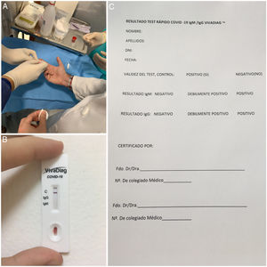 A) photograph showing the extraction of a capillary total blood sample from a fingertip. B) negative results of a fast test taken by an ophthalmologist of the authors’ department. C) report certifying the results of the diagnostic test.