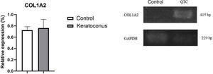 Collagen I gene expression in the keratoconus animal model. Although there is no significant change, a trend towards increased expression of type I collagen in the keratoconus group is evidenced. Data are presented as mean+standard error; n=6 per group. bp: base pairs; COL1A2: collagen type I alpha chain 2; QTC: keratoconus.