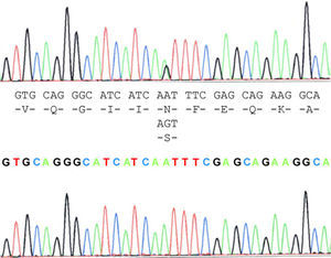 Electropherogram for SOD1 exon 1, showing exon 1 and the protein sequences compared to the control.